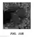 Fig. 16 - COMPOSITIONS AND METHODS FOR DETECTING AND/OR TREATING INFLAMMATION