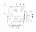 Fig. 02 - Multi-camera laser scanner