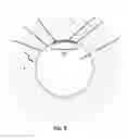 Fig. 06 - Systems, Methods, Apparatuses, and Software for Measuring Electrical Properties of a Material