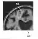 Fig. 01 - Brain tissue classification