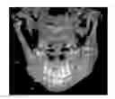 Fig. 01 - Alignment of mixed-modality data sets for reduction and removal of imaging artifacts
