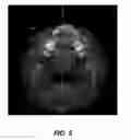 Fig. 07 - Alignment of mixed-modality data sets for reduction and removal of imaging artifacts