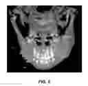 Fig. 08 - Alignment of mixed-modality data sets for reduction and removal of imaging artifacts