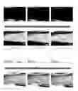Fig. 01 - Automatic compensation for the light attenuation due to epidermal melanin in skin images