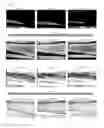 Fig. 06 - Automatic compensation for the light attenuation due to epidermal melanin in skin images