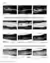Fig. 07 - Automatic compensation for the light attenuation due to epidermal melanin in skin images