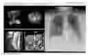 Fig. 01 - Method and system for rule-based display of sets of images