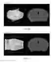 Fig. 09 - Methods and software for creating a 3D image from images of multiple histological sections and for mapping anatomical information from a reference atlas to a histological image