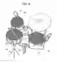 Fig. 07 - REDUCED VOLUME DRUMS AND COMPONENTS THEREOF