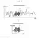 Fig. 06 - Speech Signal Processing System and Devices