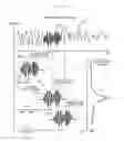 Fig. 07 - Speech Signal Processing System and Devices