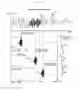 Fig. 08 - Speech Signal Processing System and Devices