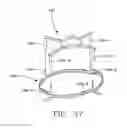 Fig. 35 - Symmetrical plural-coil plasma source with side RF feeds and RF distribution plates