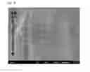 Fig. 03 - Steel foil for electrical storage device container, container for electrical storage device, and electrical storage device