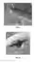 Fig. 06 - Flexible, planar, double sided air breathing microscale fuel cell
