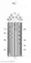 Fig. 02 - Catalyst layer for fuel cell