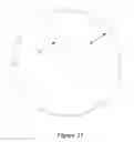 Fig. 10 - Hearing device incorporating conformal folded antenna