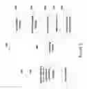 Fig. 06 - SYSTEMS AND METHODS FOR PERFORMING SELF-SIMILARITY UPSAMPLING
