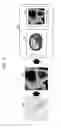 Fig. 08 - MEDICAL IMAGING APPARATUS, MEDICAL IMAGE PROCESSING METHOD, AND COMPUTER-READABLE RECORDING MEDIUM RELATED TO THE MEDICAL IMAGE PROCESSING METHOD