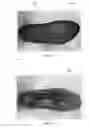 Fig. 02 - System and Method for Stabilizing Footwear