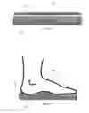 Fig. 04 - System and Method for Stabilizing Footwear