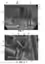 Fig. 02 - Touch fastener