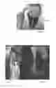 Fig. 09 - APPARATUS FOR CARRYING BAGS AND METHOD OF USING IT