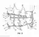 Fig. 08 - Modular apparatus and system for accommodating and dispensing cans and a method for forming the same