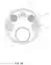 Fig. 08 - Flexible digital ureteroscope