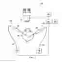 Fig. 02 - Systems and methods using a vitreous visualization tool