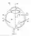 Fig. 03 - Systems and methods using a vitreous visualization tool