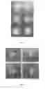 Fig. 04 - METHOD AND SYSTEM FOR CLASSIFYING OPTIC NERVE HEAD