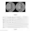 Fig. 09 - METHOD AND SYSTEM FOR CLASSIFYING OPTIC NERVE HEAD
