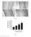 Fig. 07 - Method and Device for Detecting UV-Induced Skin Damage by In Vivo Non-Invasive Detection