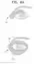 Fig. 13 - Apparatus and method for measuring biologic parameters
