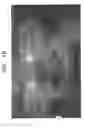 Fig. 15 - Apparatus and method for measuring biologic parameters