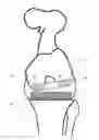 Fig. 01 - Determining a range of motion of an artificial knee joint