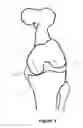 Fig. 04 - Determining a range of motion of an artificial knee joint