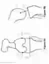 Fig. 06 - Determining a range of motion of an artificial knee joint
