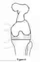 Fig. 07 - Determining a range of motion of an artificial knee joint