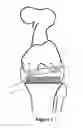 Fig. 08 - Determining a range of motion of an artificial knee joint