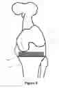 Fig. 09 - Determining a range of motion of an artificial knee joint