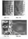 Fig. 02 - SYSTEMS AND METHODS FOR IDENTIFICATION AND PREDICTION OF STRUCTURAL SPINE PAIN