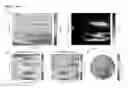 Fig. 07 - Feedback brain stimulation to enhance sleep spindles, modulate memory and cognitive function, and treat psychiatric and neurological symptoms