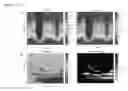 Fig. 08 - Feedback brain stimulation to enhance sleep spindles, modulate memory and cognitive function, and treat psychiatric and neurological symptoms