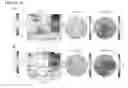 Fig. 10 - Feedback brain stimulation to enhance sleep spindles, modulate memory and cognitive function, and treat psychiatric and neurological symptoms
