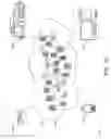 Fig. 10 - Brain wave processing for diagnosis of a subject