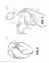 Fig. 05 - Method and system for modeling blood flow with boundary conditions for optimized diagnostic performance