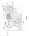 Fig. 07 - Medical image processing apparatus, medical image processing method, computer-readable medical-image processing program, moving-object tracking apparatus, and radiation therapy system