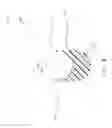 Fig. 09 - Marker delivery device for use with MRI breast biopsy system